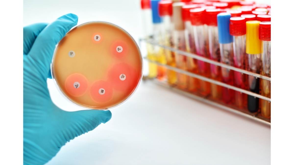 Recubrimiento antimicrobiano