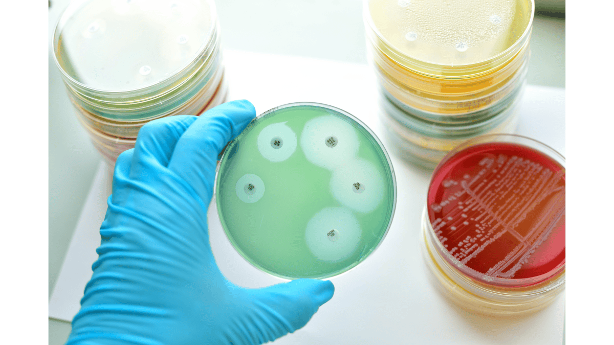 Revestimiento antimicrobiano